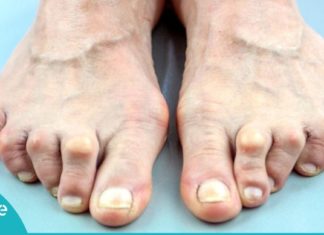 საუკეთესო საშუალება რევმატოიდული ართრიტის დროს- ტკივილი უკვალოდ გაქრება! გაიგეთ მეტი…