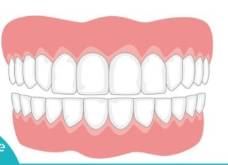 როგორ უნდა გავუმკლავდეთ კბილის ნადებს სახლის პირობებში ? ეს დაგაინტერესებთ!