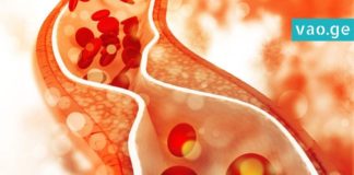 დაემშვიდობეთ ქოლესტერინს და შაქრის მაღალ დონეს ამ ნატურალური სასმელის დახმარებით