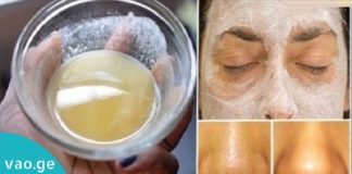 საუკეთესო სახის ნიღაბი! ეფექტური საშუალება, რომელიც ყველამ უნდა სცადოს!