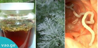 როგორ გავთავისუფლდეთ მუცლის ჭიებისგან – ეს ნატურალური საშუალებები დაგეხმარებათ!