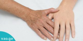 მარტივი და უიაფესი გზა შავი და ყავისფერი ლაქების მოსაშორებლად!