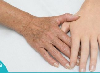 მარტივი და უიაფესი გზა შავი და ყავისფერი ლაქების მოსაშორებლად!