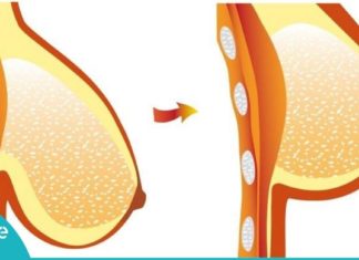 აირიდეთ თავიდან მოშვებული მკერდის პრობლემა – სასარგებლო რჩევები!