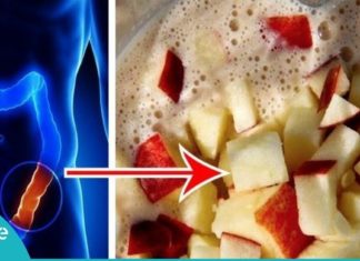 გაასუფთავეთ ნაწლავები ტოქსინებისგან-სცადეთ ყველაზე ეფექტური ბუნებრივი საშუალება!