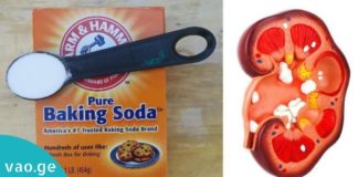 მხოლოდ ნახევარი კოვზი საკვები სოდა და თქვენს თირკმელებს აი, ეს დაემართება-ეფექტურია!