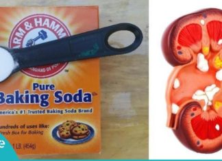 მხოლოდ ნახევარი კოვზი საკვები სოდა და თქვენს თირკმელებს აი, ეს დაემართება-ეფექტურია!