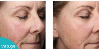 მოიშორეთ ნაოჭები, ზედმეტი ცხიმები და გაიღიავეთ სახის კანი სულ რაღაც 1 კვირაში!