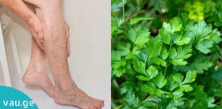 როგორ გავიქროთ ვარიკოზული ვენები ოხრახუშის დახმარებით? იაფი და მარტივი მეთოდი