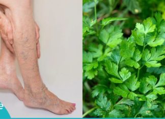 როგორ გავიქროთ ვარიკოზული ვენები ოხრახუშის დახმარებით? იაფი და მარტივი მეთოდი