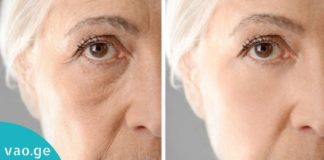 სამი ყველაზე ეფექტური საშუალება ნაოჭების წინააღმდეგ. ის, რაც უკვე ბევრმა სცადა