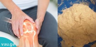 ცომის კომპრესი, რომელიც სახსრების ტკივილს ერთ ღამეში მოგიხსნით. მარტივი და ეფექტური მეთოდი