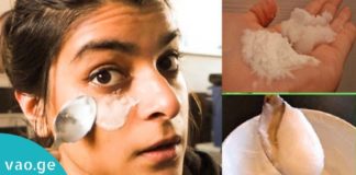 როგორ ვებრძოლოთ შავ წრეებს თვალების გარშემო? ამისთვის თქვენ მხოლოდ აი ეს დაგჭირდებათ