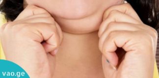 როგორ მოვიშოროთ ჭარბი ცხიმი სახიდან და კისრიდან? ყველაზე სასარგებლო რჩევები