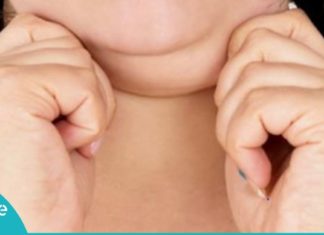 როგორ მოვიშოროთ ჭარბი ცხიმი სახიდან და კისრიდან? ყველაზე სასარგებლო რჩევები