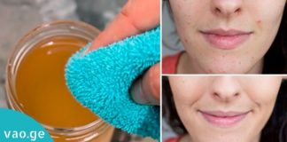 რა ემართება სახის კანს, როცა მას ვაშლის ძმრით იბანთ?გამოიყენება ნაოჭების საწინააღმდეგოდ