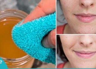 რა ემართება სახის კანს, როცა მას ვაშლის ძმრით იბანთ?გამოიყენება ნაოჭების საწინააღმდეგოდ