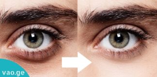 შეშუპებული და ჩაშავებული თვალები გაქვთ? ეს მეთოდი 2 წუთში სილამაზეს დაგიბრუნებთ