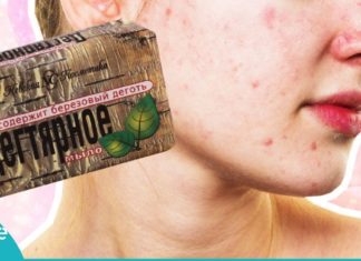 კუპრის საპონის გამოყენების გზები თავის მოვლისთვის. იაფი და ეფექტური საშუალება