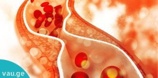 ჩემს სისხლში ნაკლები ქოლესტერინი და შაქარია, აი ამ პროდუქტის წყალობით!