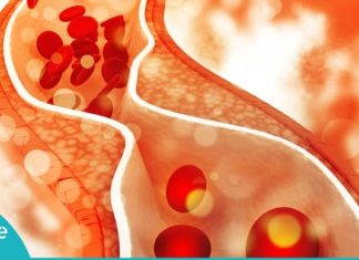 ჩემს სისხლში ნაკლები ქოლესტერინი და შაქარია, აი ამ პროდუქტის წყალობით!