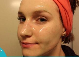 მან სახეზე აი, ამ ორი ინგრედიენტისგან მომზადებული ნაზავი წაისვა. შედეგი? საოცარია!