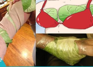 დაიდეთ კომბოსტოს ფოთლები ასე და გათავისუფლდით ტკივილისგან! სასარგებლო რჩევები თქვენთვის