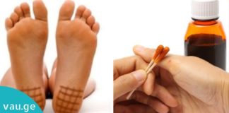 აი როგორ უნდა იოდის ბადის დახატვა ფეხის ქუსლებზე! ეფექტურია ფეხების შეშუპების წინააღმდეგ
