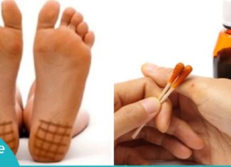 აი როგორ უნდა იოდის ბადის დახატვა ფეხის ქუსლებზე! ეფექტურია ფეხების შეშუპების წინააღმდეგ