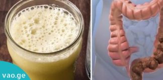 როგორ მოვიწესრიგოთ ორგანიზმი სახლის პირობებში? 10 ხერხი, რომელიც ნაწლავებს გაასუფთავებს!