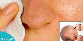 ამ მარტივი რეცეპტის საშუალებით ფერიმჭამელებისგან მყისვე გათავისუფლდებით. ეფექტურია