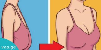 მიზეზები, რომლებიც ქალებში მკერდის დაწევას იწვევს და მისი თავიდან აცილების გზები…