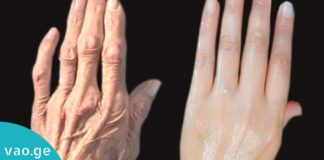 მედიცინაში ახალი სასწაულმოქმედი კრემი გამოჩნდა! ზეთსანთელა ხელის კანის დაბერებას აჩერებს