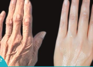 მედიცინაში ახალი სასწაულმოქმედი კრემი გამოჩნდა! ზეთსანთელა ხელის კანის დაბერებას აჩერებს