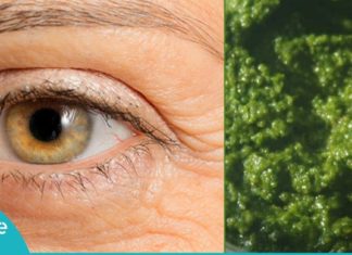 ოხრახუშის ნიღაბი თვალის ირგვლივ არსებული ნაოჭებისთვის. მისი ეფექტურობა გაგაოცებთ!