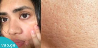 ინგრედიენტი, რომელიც სახის ღია ფორებს შველის. ყველაზე ეფექტური მეთოდი