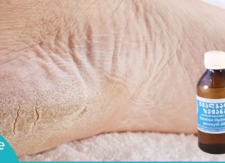 აი, როგორ უნდა გამოიყურებოდეს თქვენი ქუსლები ლამაზად-სუპერ ეფექტური მეთოდი!