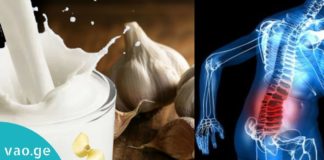 რძე და ნიორი-ეფექტური კომბინაცია რადიკულიტთან საბრძოლველად! გაიგეთ მეტი…