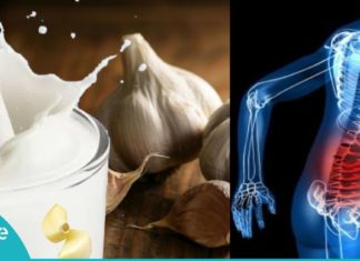 რძე და ნიორი-ეფექტური კომბინაცია რადიკულიტთან საბრძოლველად! გაიგეთ მეტი…
