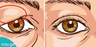 ჩამოწელილ ქუთუთოებს ამ მარტივი საშუალებით გაიქრობთ. იაფი და ეფექტურია