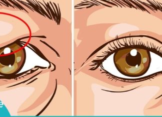 ჩამოწელილ ქუთუთოებს ამ მარტივი საშუალებით გაიქრობთ. იაფი და ეფექტურია