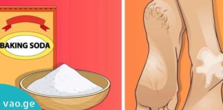 როგორ დავარბილოთ გაუხეშებული და დამსკდარი ქუსლები? ის, რაც მარტივი და ეფექტურია