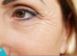 როგორ მოვიშოროთ თვალების კუთხეებში გაჩენილი ნაოჭები? ყველაზე სწრაფი მეთოდები