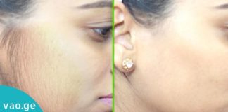 როგორ მოვიშოროთ არასასურველი თმა სახიდან? ეფექტური და მარტივი მეთოდი