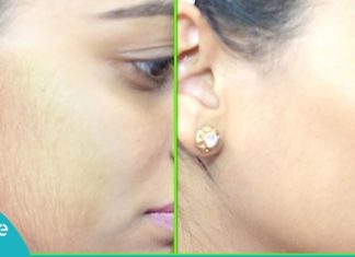 როგორ მოვიშოროთ არასასურველი თმა სახიდან? ეფექტური და მარტივი მეთოდი