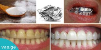 კბილების გათეთრების ყველაზე უცნაური და ეფექტური მეთოდი. საჭირო ინფორმაციაა