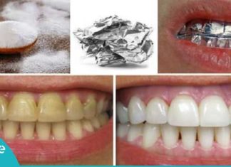 კბილების გათეთრების ყველაზე უცნაური და ეფექტური მეთოდი. საჭირო ინფორმაციაა