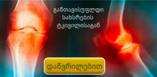 განთავისუფლდი სახსრების ტკივილისაგან