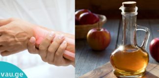 ვაშლის ძმარი ართრიტის წინააღმდეგ, ეს უნდა იცოდეთ !