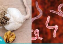 ეს პროდუქტები ორგანიზმს პარაზიტებისგან იცავენ. ინფორმაცია, რომელიც ყველამ უნდა იცოდეს